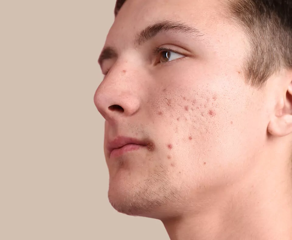 home-1-before-image-three home-1-before-image-three